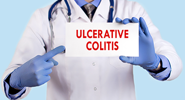 Ulcerative Colitis